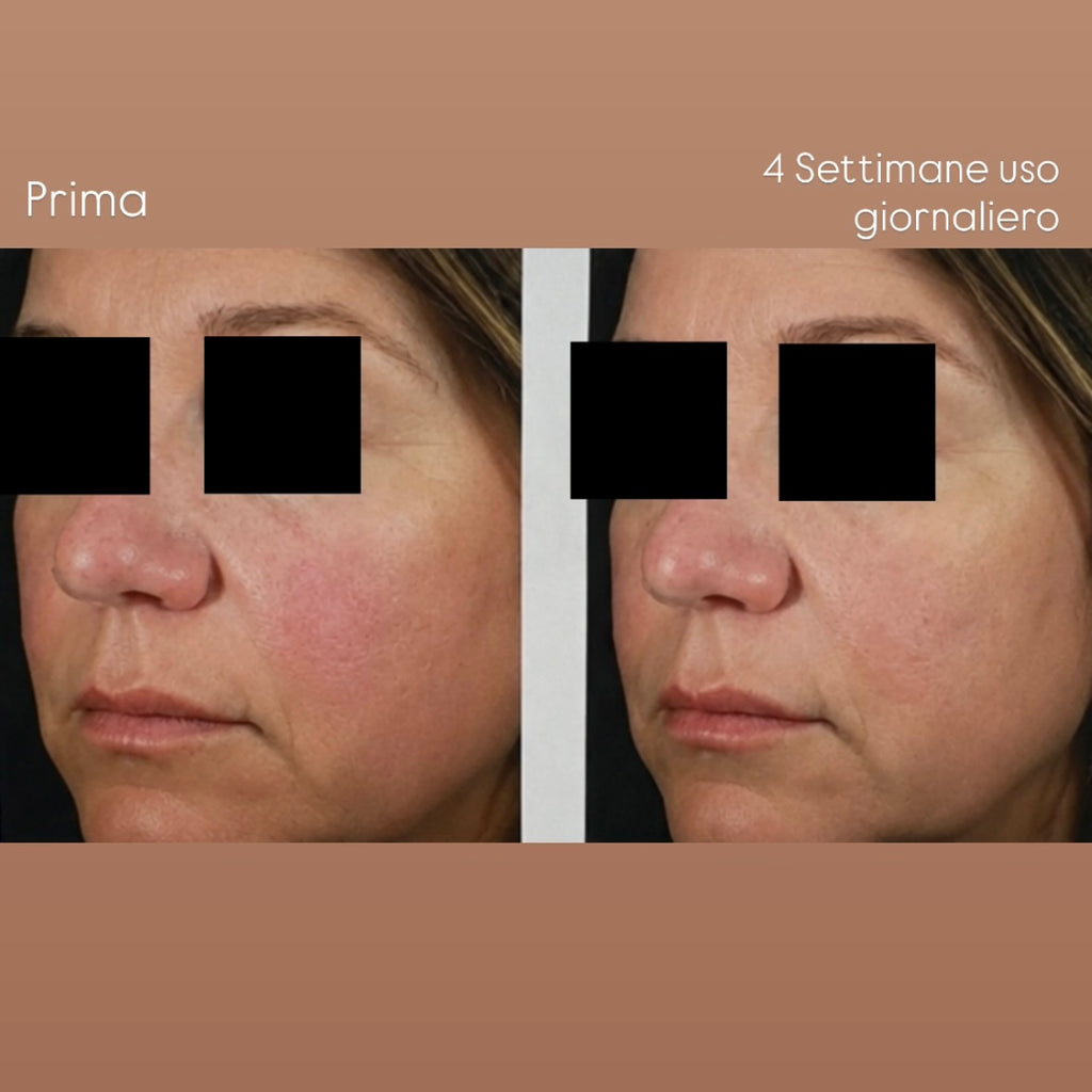 Crema Lenitiva per Pelli Sensibili e Reattive