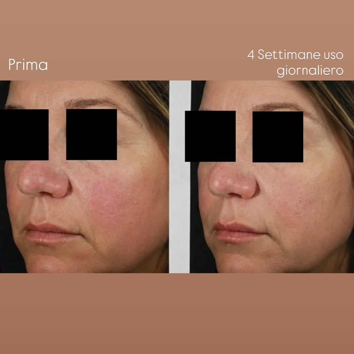 Crema Lenitiva per Pelli Sensibili e Reattive