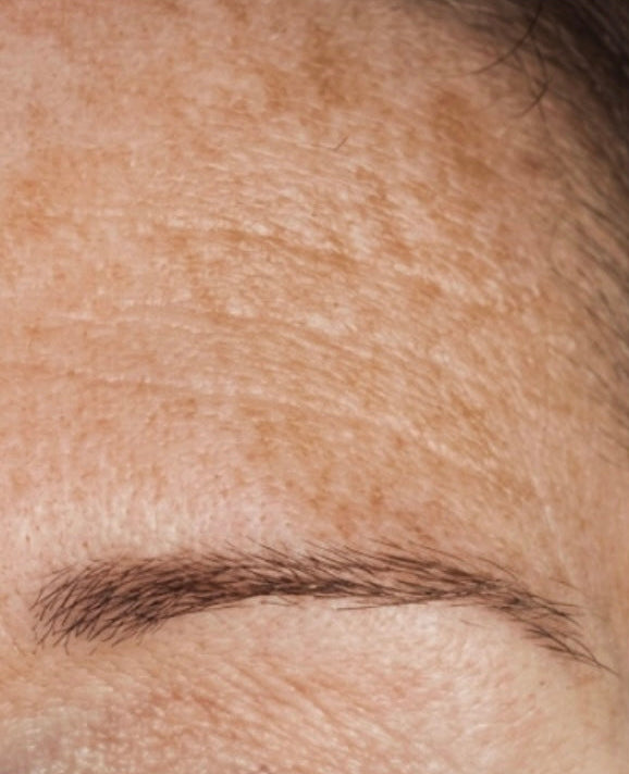 Crema Viso con Acido Ialuronico e Retinolo